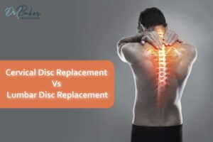 Cervical Vs Lumbar Disc Replacement