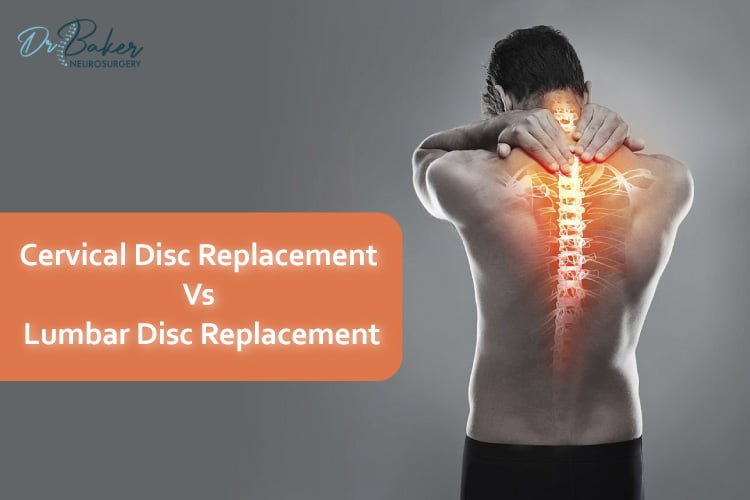 Cervical Vs Lumbar Disc Replacement