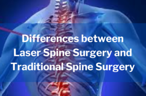 Differences Between Laser Spine Surgery And Traditional Spine Surgery