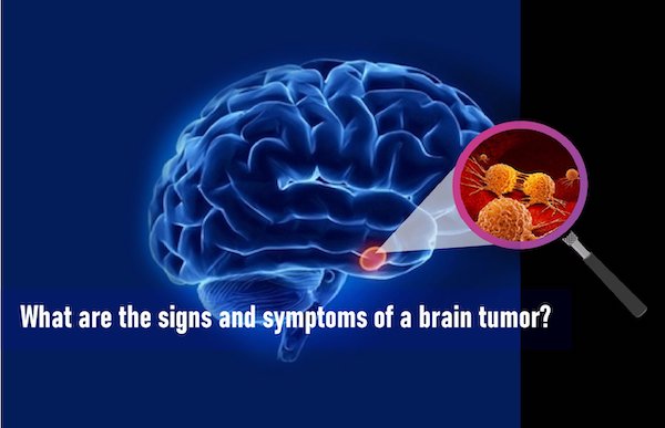 What Are The Signs And Symptoms Of A Brain Tumor