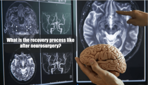 What Is The Recovery Process Like After Neurosurgery?