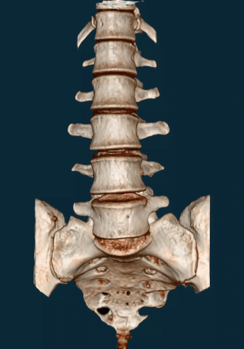 Brain &Amp; Spine Trauma/Injury Surgery | Dr. Abdul A. Baker, Md - Neurosurgeon