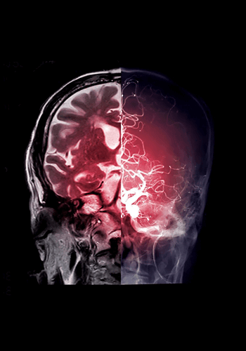 Brain-Spine-Shunting-Procedures