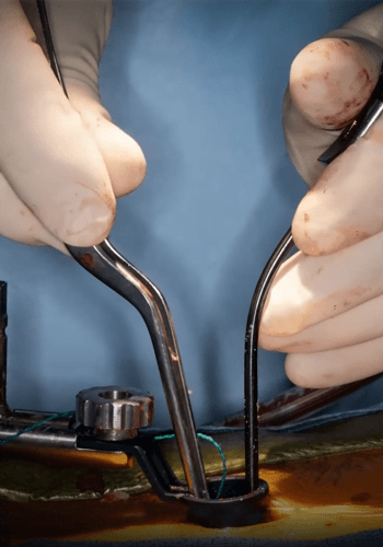 Minimally-Invasive-Spine-Surgery-2 Minimally-Invasive-Spine-Surgery-2