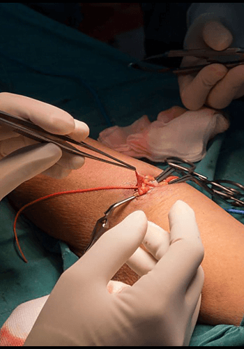 Peripheral-Nerve-Surgery