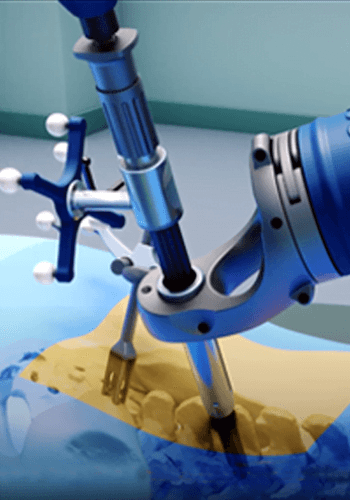 Robotic-Spine-Surgery-2