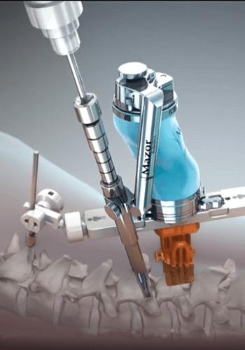 Roboticsurgery-1