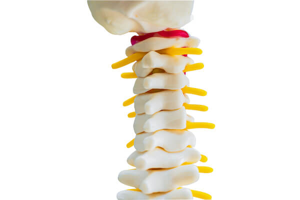 Lumbar Spine Minimally Invasive Procedures Minimally Invasive Spine Procedures Minimally Invasive Spinal Fusion Spinal Column Bone Graft Herniated Disc Physical Therapy Soft Tissue Surrounding Soft Tissue Small Incisions Nerve Roots Minimally Invasive Technique