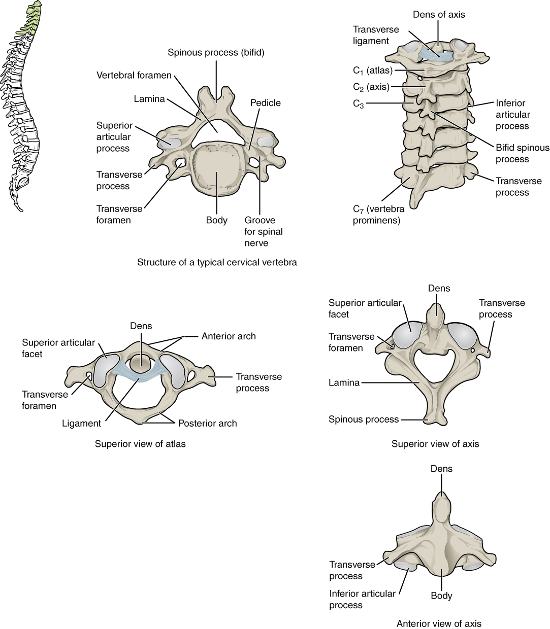 C5 C6 Disc Spinal Fusion Physical Therapy Cervical Herniated Disc Cervical Radiculopathy Spinal Nerve Facet Joints Vertebral Arch Minor Symptoms Upper Arms Invertebral Foramen Pinched Nerve Disc Herniations Bulging Discs