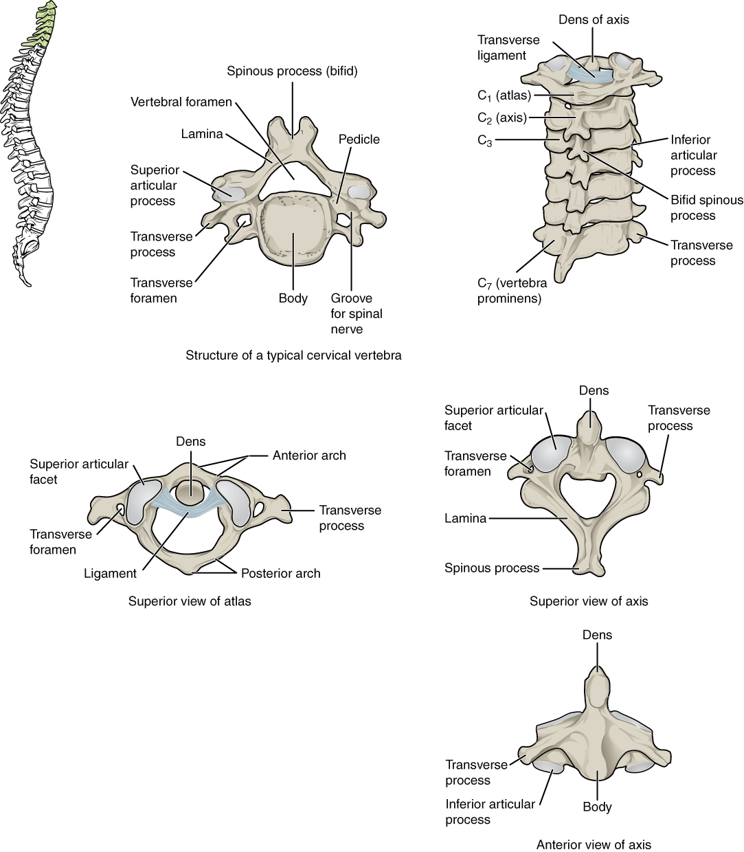 c5 c6 disc spinal fusion physical therapy cervical herniated disc cervical radiculopathy spinal nerve facet joints vertebral arch minor symptoms upper arms invertebral foramen pinched nerve disc herniations bulging discs